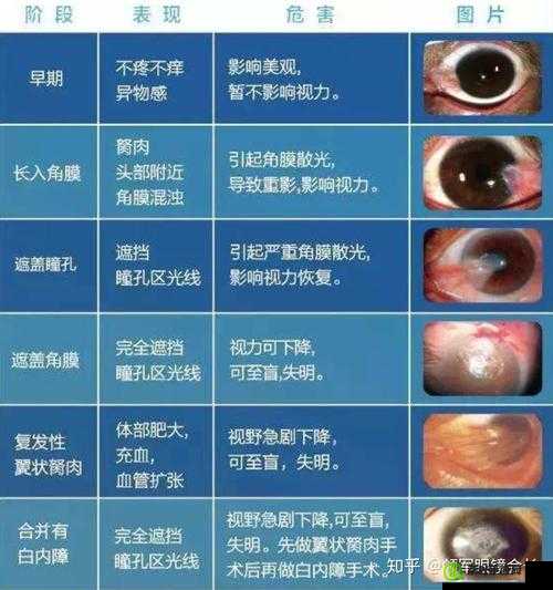 获得超级胬肉系统怎么办：这可咋整